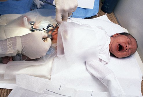 Circumcision Recovery